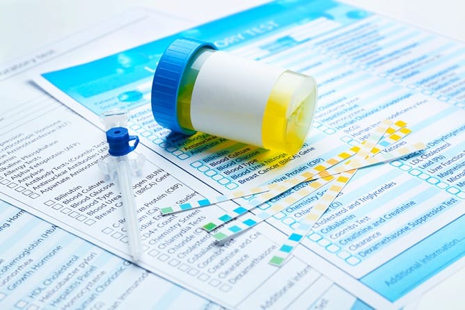 Gros plan sur des resultats d'un test urinaire avec un echantillon d'urine