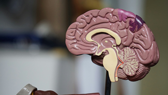 La coupe d'un cerveau representant les bienfaits d'une infusion au CBD pour protéger le cerveau